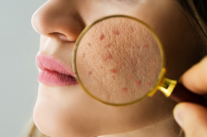 Department of Aesthetic Dermatology