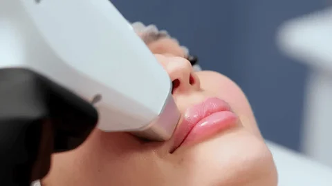 face laser hair removal Ajman