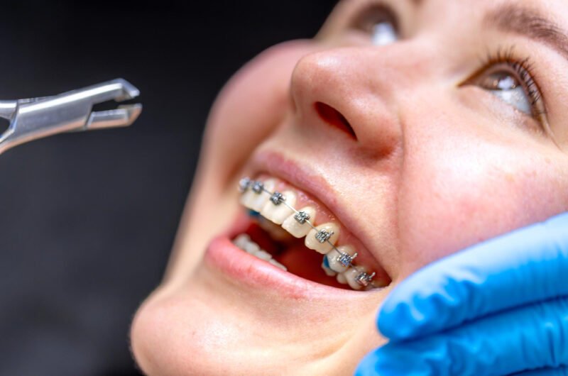 Braces Specialist Ajman