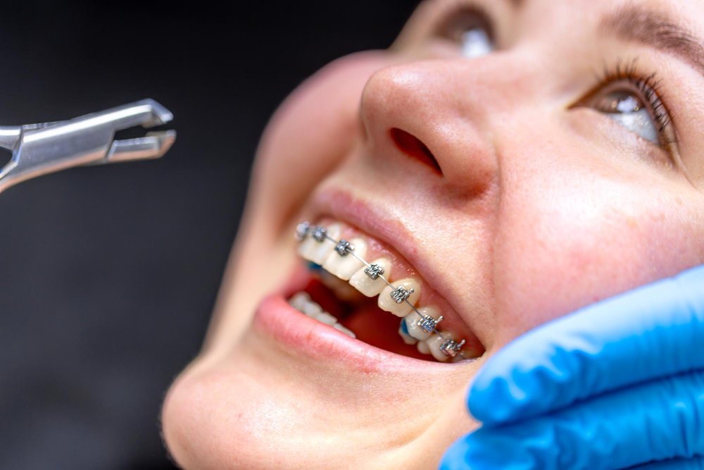 Braces Specialist Ajman