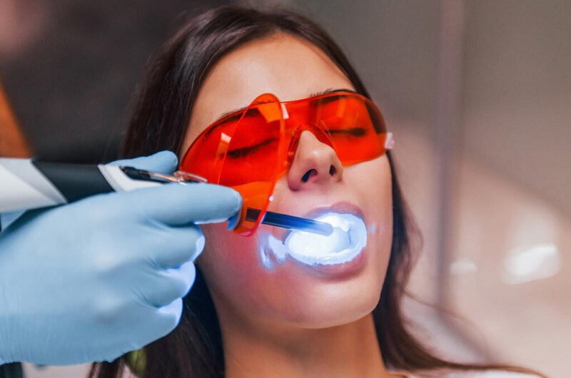 Cosmetic Dentistry Service Ajman