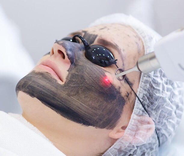 carbon laser facial clinic Dubai