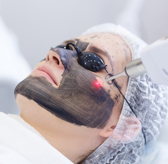 carbon laser facial clinic Dubai