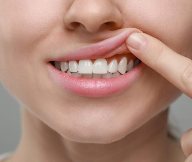 gum treatment service Ajman