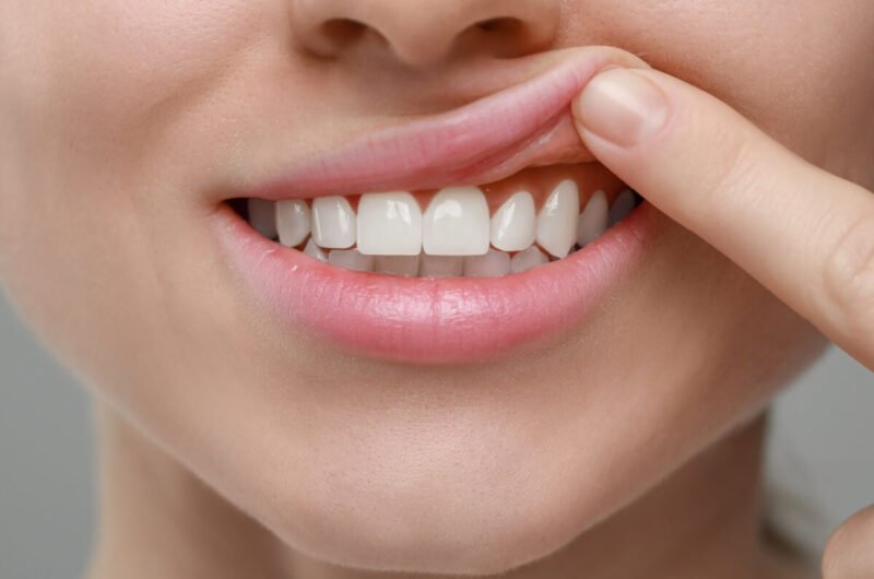 Gum Treatment Service Ajman