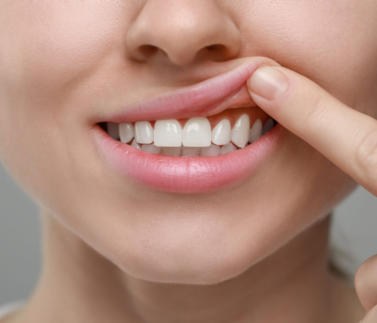 gum treatment service Ajman