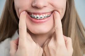 Braces specialist Ajman