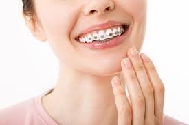 Braces specialist Ajman