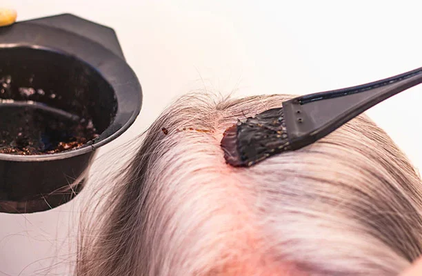 Hair dye allergy specialist Ajman