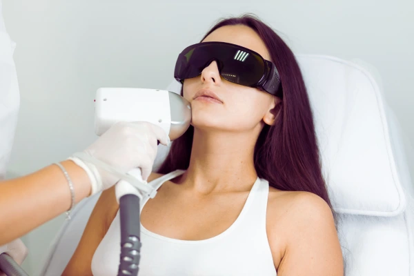 Face Laser Hair Removal Ajman