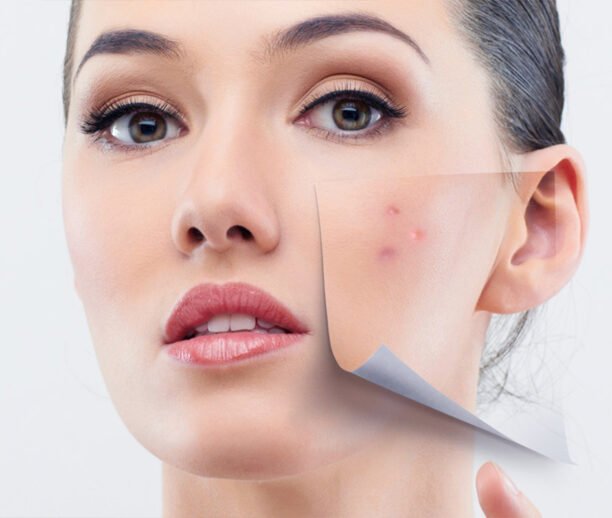 Scar removal Ajman