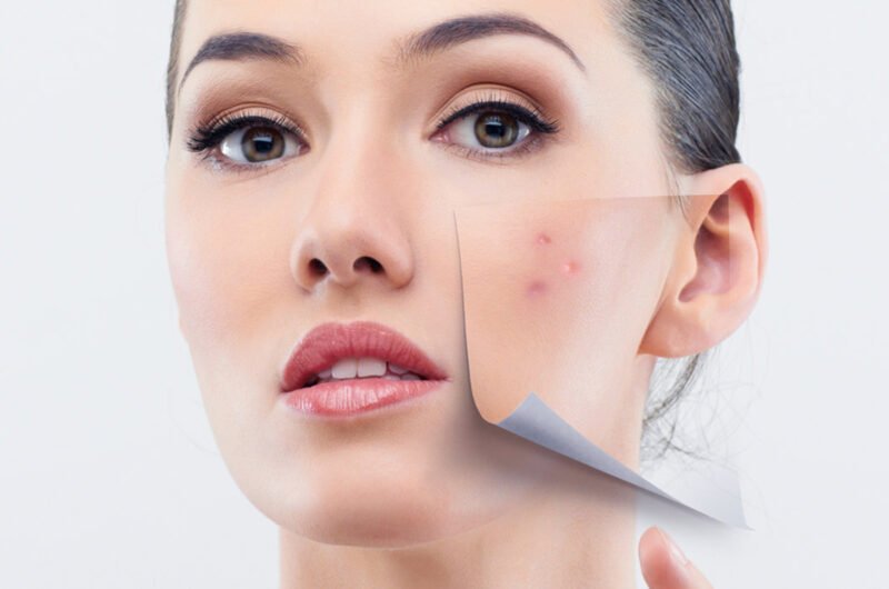 Scar Removal Ajman