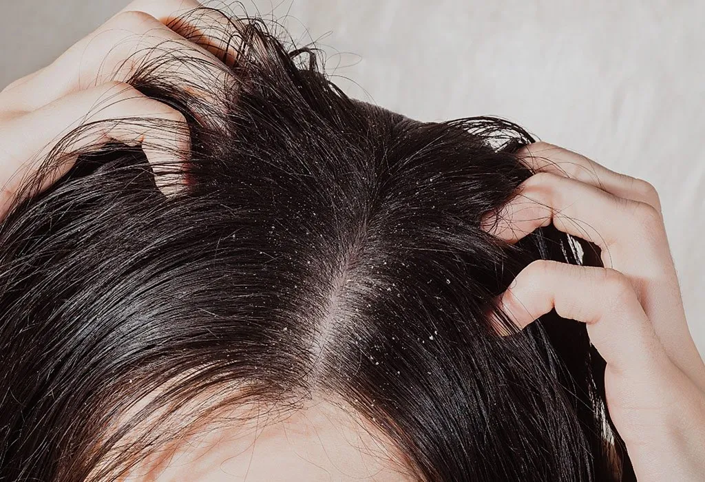Dandruff treatment Ajman