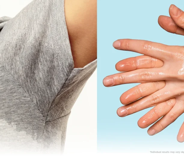 Hyperhidrosis treatment Ajman