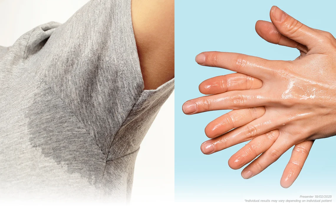 Over sweating treatment Ajman