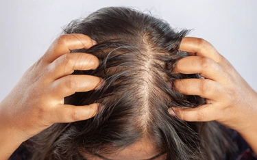Hair fall treatment Ajman