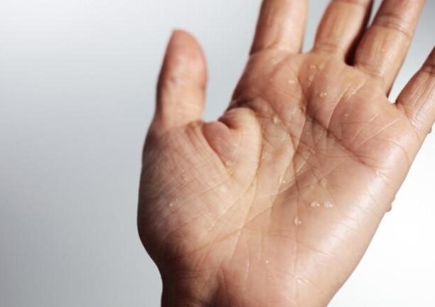 Hyperhidrosis treatment Ajman