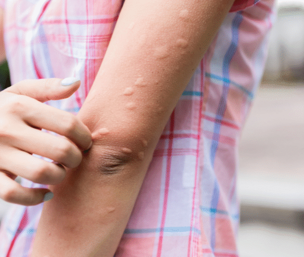 Skin infection treatment Ajman