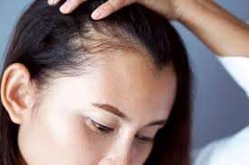 Hair Fall Treatment Ajman