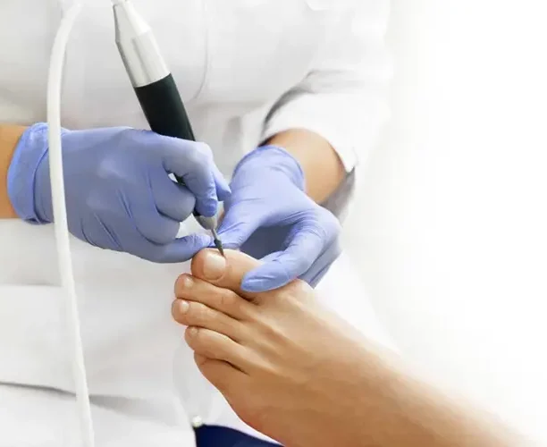 Nail infection treatment Ajman