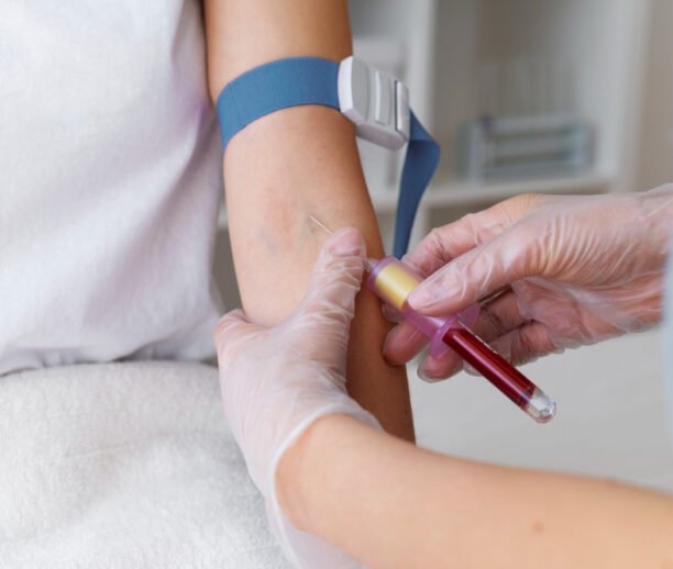 IV for skin rejuvenation Ajman