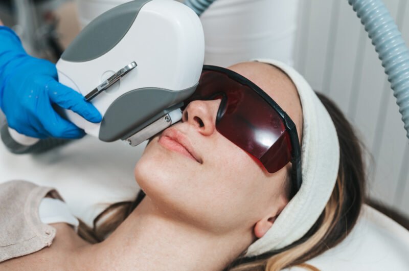 Laser Hair Reduction Ajman