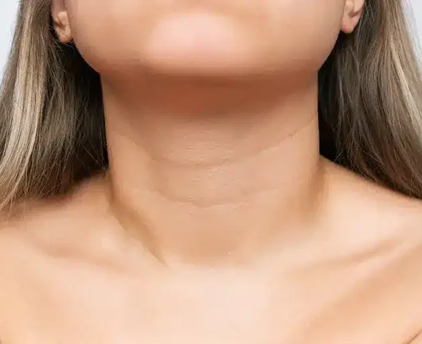 Neck rejuvenation Ajman